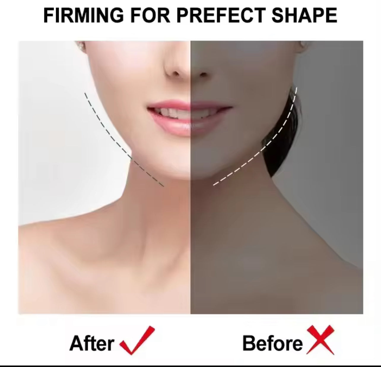 LIFTING VISAGE